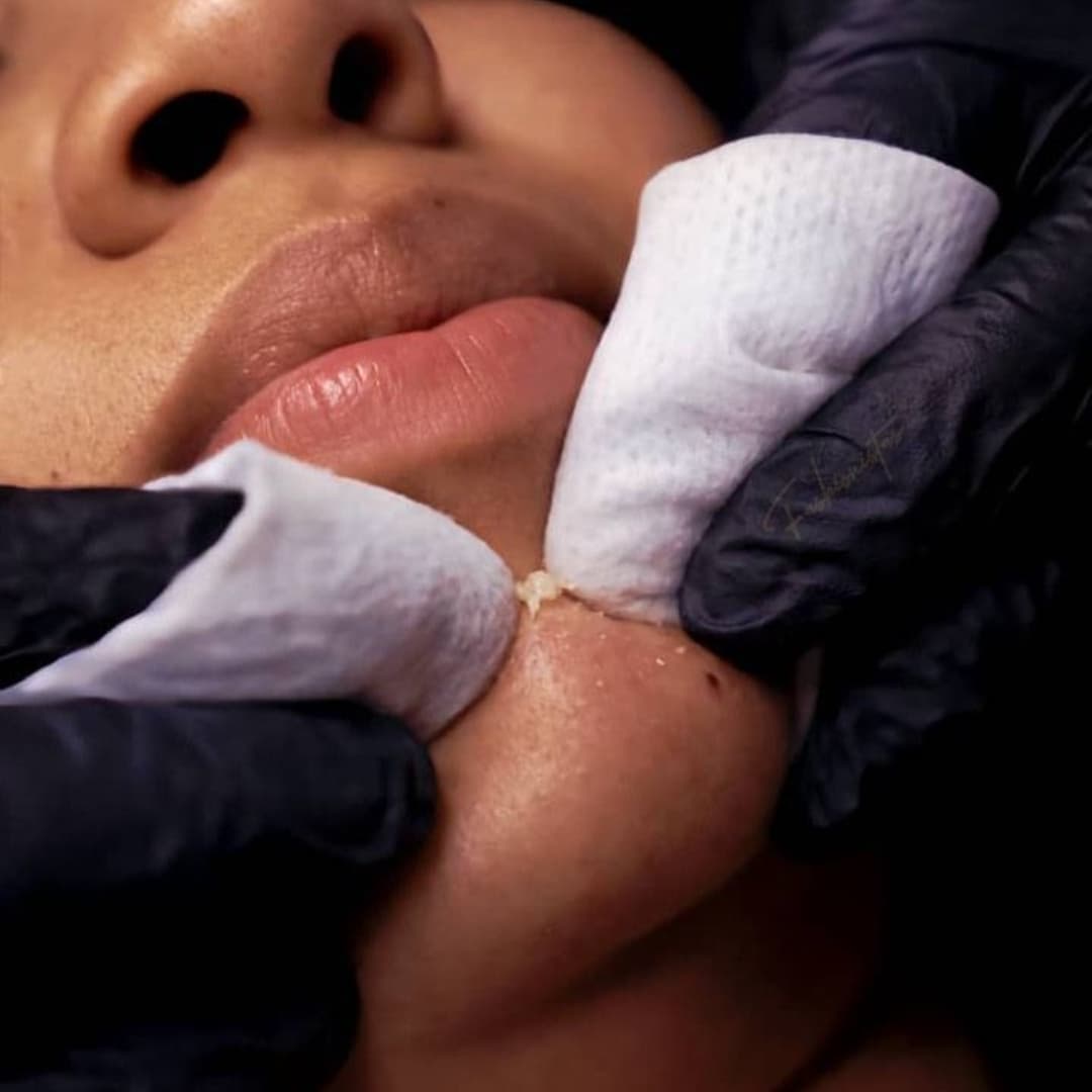 ¡Haz que tu piel vuelva a brillar! Paga RD$1,449 en vez de RD$4,500 por una limpieza facial profunda más hidrafacial y masaje facial solo en Velarosa Spa y Stetic Center. — imagen 1
