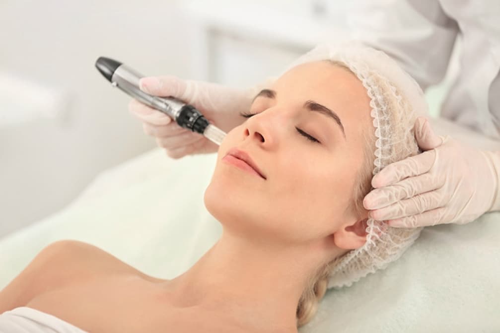 Paga RD$1,799 en vez de RD$4,000 por limpieza facial profunda con Dermapen, ácido hialurónico y microdermoabrasión